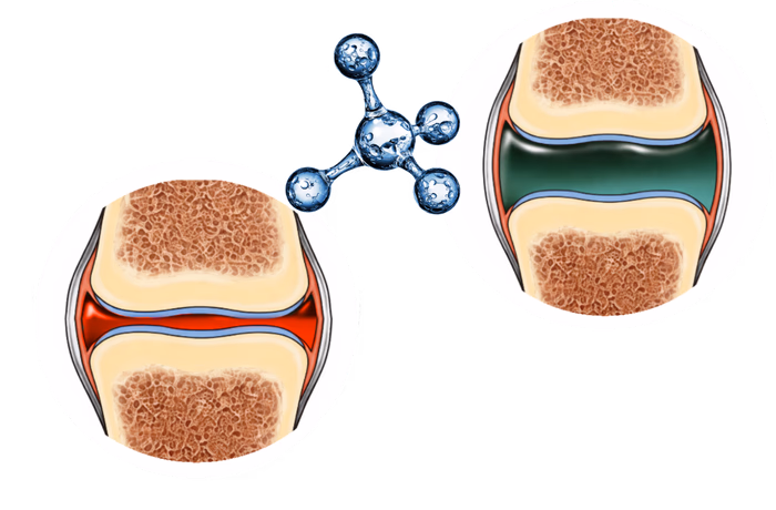 Illustration showing the difference between healthy synovial fluid and synovial fluid under high-demand athletic stress
